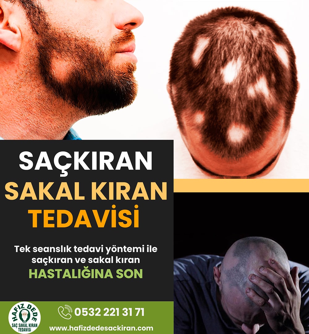sac-sakal-kiran-ilaci